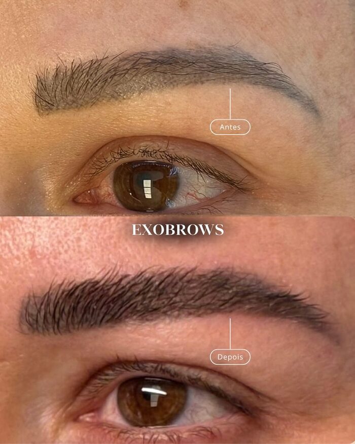 Antes e depois de sobrancelha